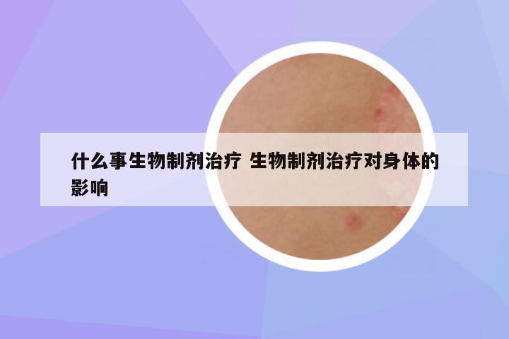 什么事生物制剂治疗 生物制剂治疗对身体的影响