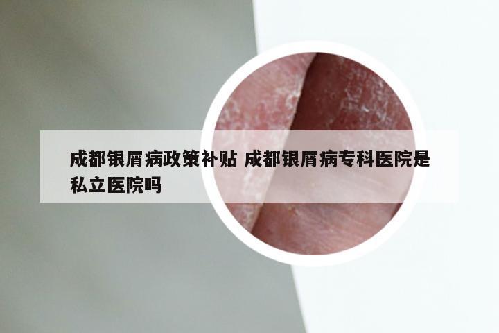 成都银屑病政策补贴 成都银屑病专科医院是私立医院吗