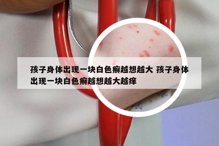 孩子身体出现一块白色癣越想越大 孩子身体出现一块白色癣越想越大越痒