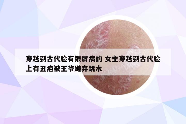 穿越到古代脸有银屑病的 女主穿越到古代脸上有丑疤被王爷嫌弃跳水