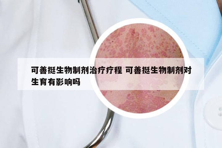 可善挺生物制剂治疗疗程 可善挺生物制剂对生育有影响吗