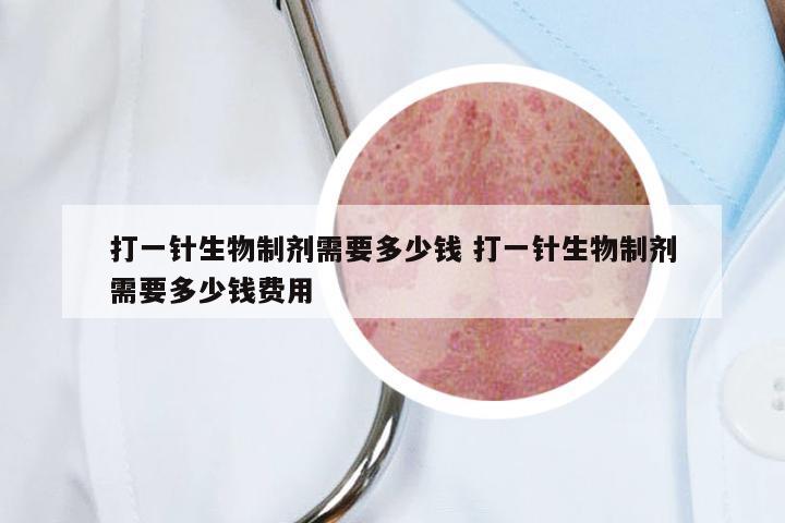 打一针生物制剂需要多少钱 打一针生物制剂需要多少钱费用