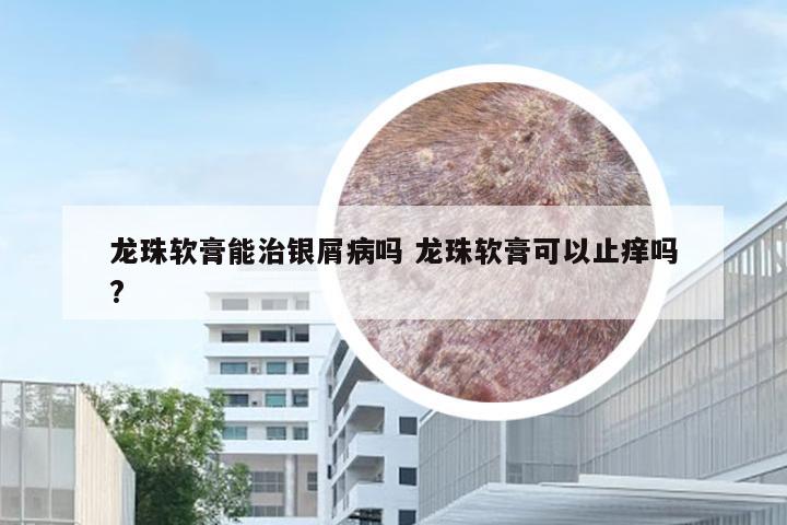 龙珠软膏能治银屑病吗 龙珠软膏可以止痒吗?