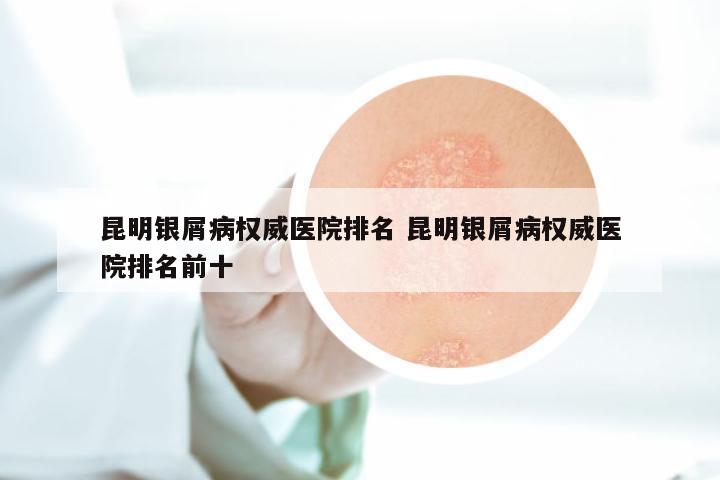 昆明银屑病权威医院排名 昆明银屑病权威医院排名前十