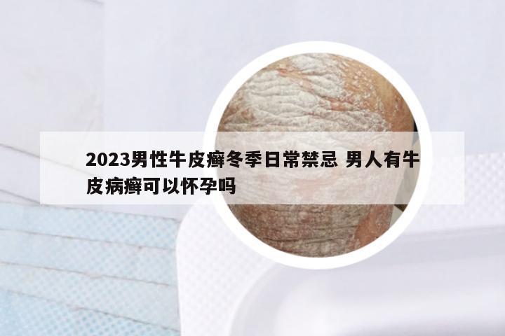 2023男性牛皮癣冬季日常禁忌 男人有牛皮病癣可以怀孕吗