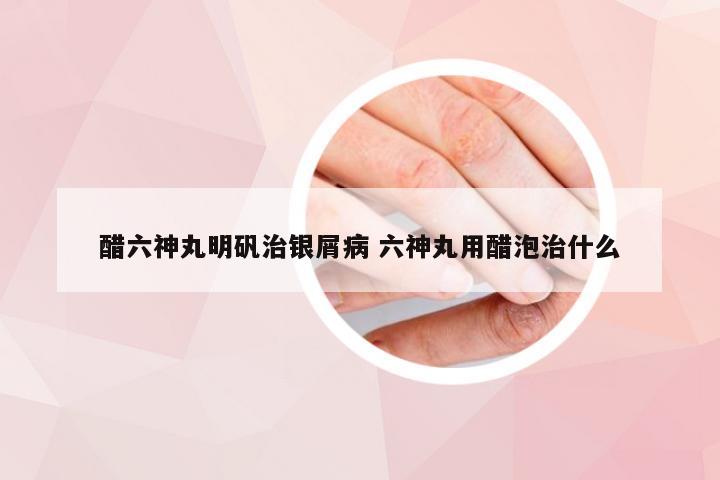 醋六神丸明矾治银屑病 六神丸用醋泡治什么