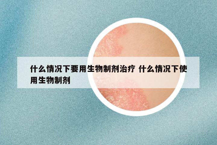 什么情况下要用生物制剂治疗 什么情况下使用生物制剂