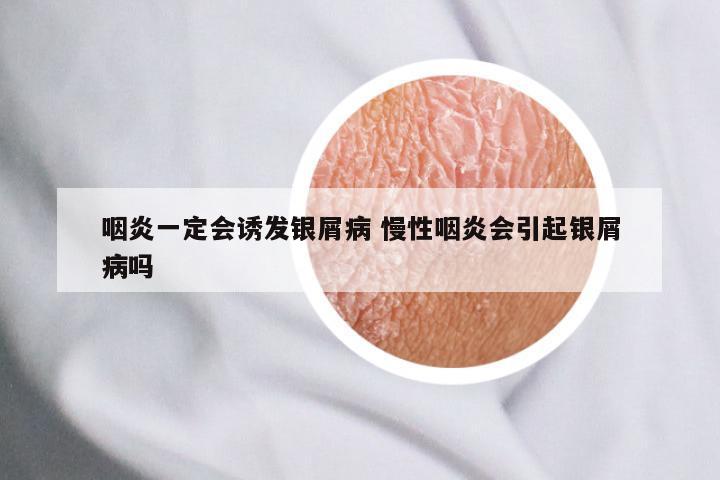 咽炎一定会诱发银屑病 慢性咽炎会引起银屑病吗