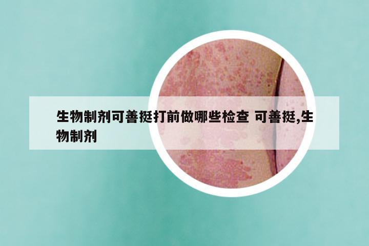 生物制剂可善挺打前做哪些检查 可善挺,生物制剂