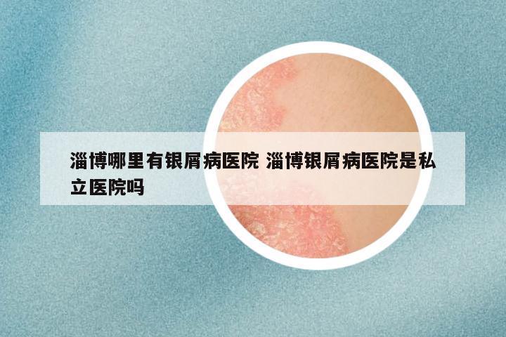 淄博哪里有银屑病医院 淄博银屑病医院是私立医院吗