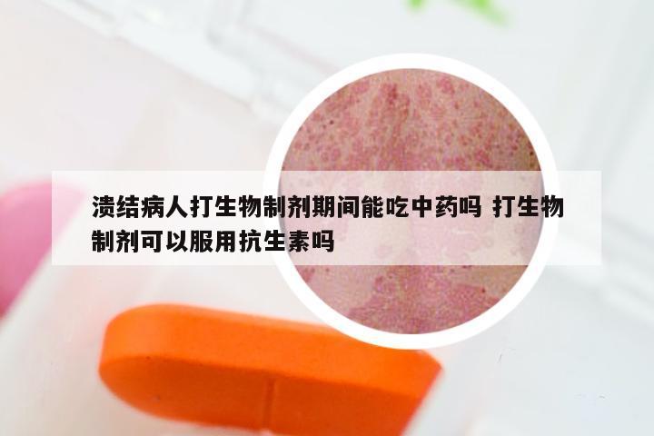 溃结病人打生物制剂期间能吃中药吗 打生物制剂可以服用抗生素吗