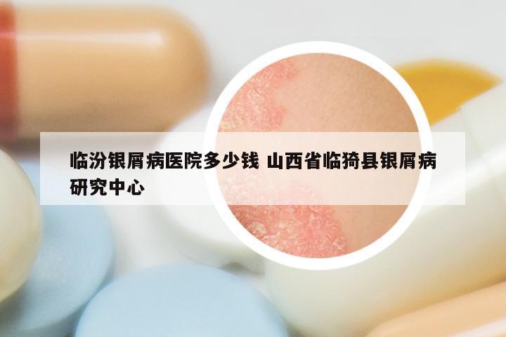 临汾银屑病医院多少钱 山西省临猗县银屑病研究中心