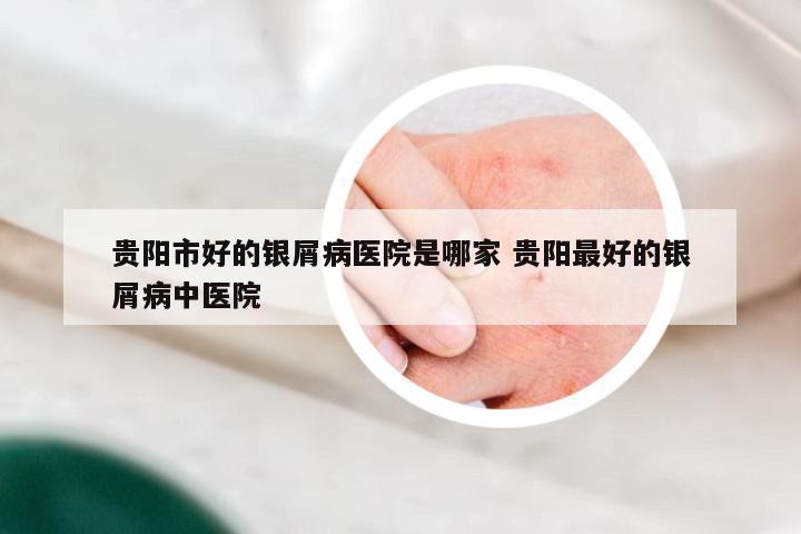 贵阳市好的银屑病医院是哪家 贵阳最好的银屑病中医院
