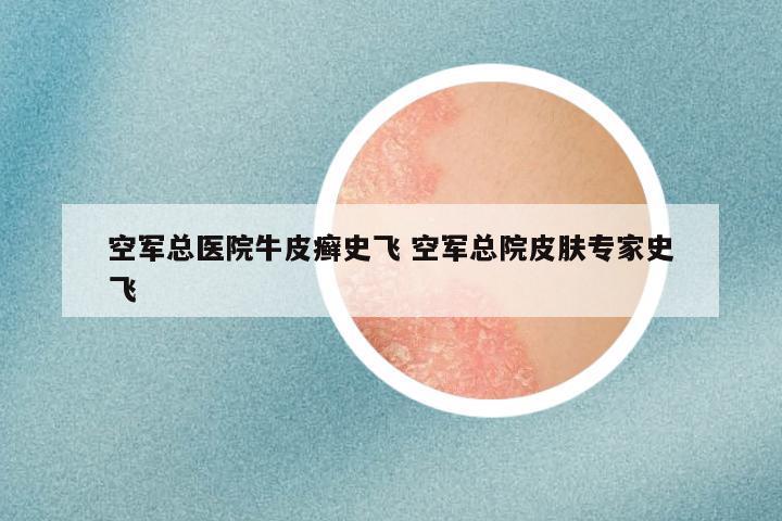 空军总医院牛皮癣史飞 空军总院皮肤专家史飞