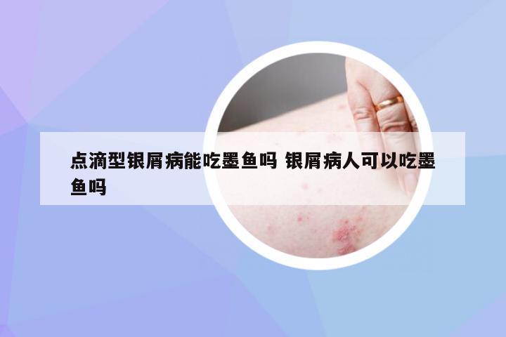点滴型银屑病能吃墨鱼吗 银屑病人可以吃墨鱼吗