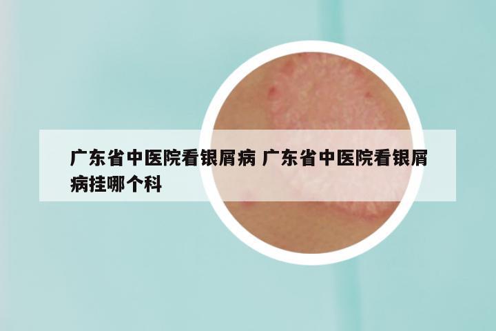 广东省中医院看银屑病 广东省中医院看银屑病挂哪个科