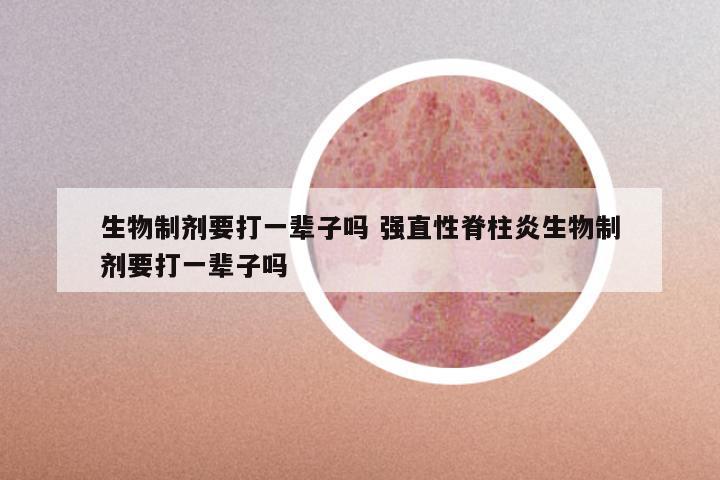 生物制剂要打一辈子吗 强直性脊柱炎生物制剂要打一辈子吗