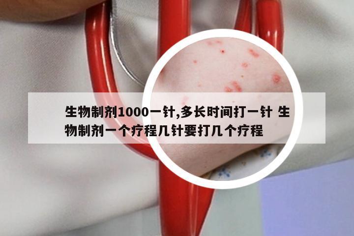 生物制剂1000一针,多长时间打一针 生物制剂一个疗程几针要打几个疗程
