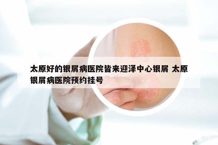 太原好的银屑病医院皆来迎泽中心银屑 太原银屑病医院预约挂号