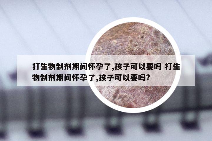打生物制剂期间怀孕了,孩子可以要吗 打生物制剂期间怀孕了,孩子可以要吗?