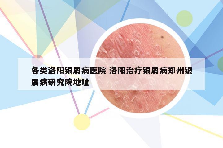各类洛阳银屑病医院 洛阳治疗银屑病郑州银屑病研究院地址