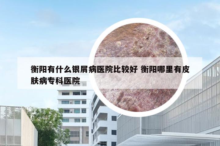 衡阳有什么银屑病医院比较好 衡阳哪里有皮肤病专科医院