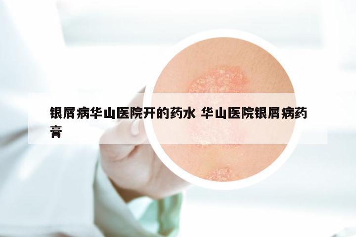 银屑病华山医院开的药水 华山医院银屑病药膏