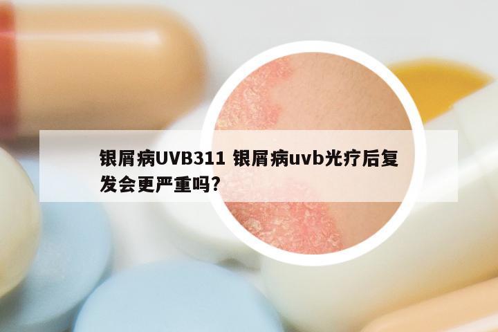 银屑病UVB311 银屑病uvb光疗后复发会更严重吗?