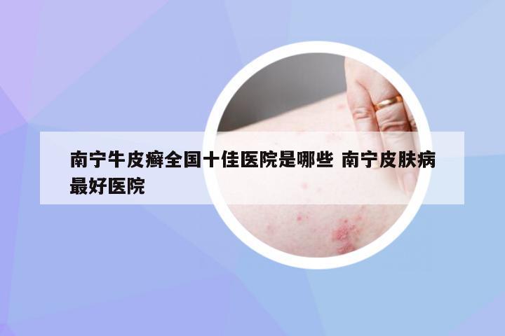 南宁牛皮癣全国十佳医院是哪些 南宁皮肤病最好医院