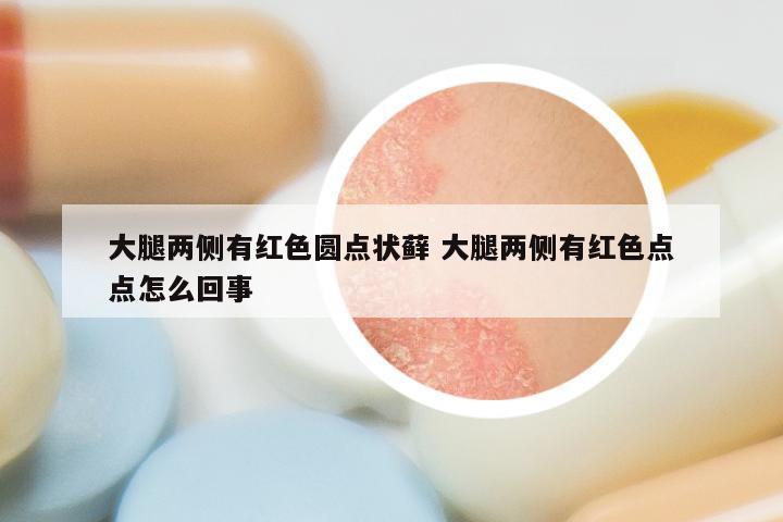 大腿两侧有红色圆点状藓 大腿两侧有红色点点怎么回事