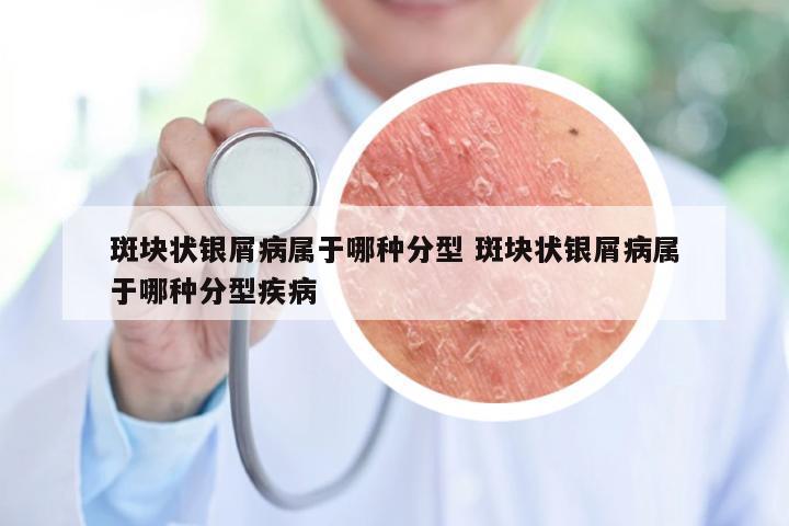 斑块状银屑病属于哪种分型 斑块状银屑病属于哪种分型疾病