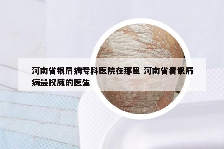 河南省银屑病专科医院在那里 河南省看银屑病最权威的医生