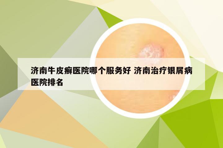 济南牛皮癣医院哪个服务好 济南治疗银屑病医院排名