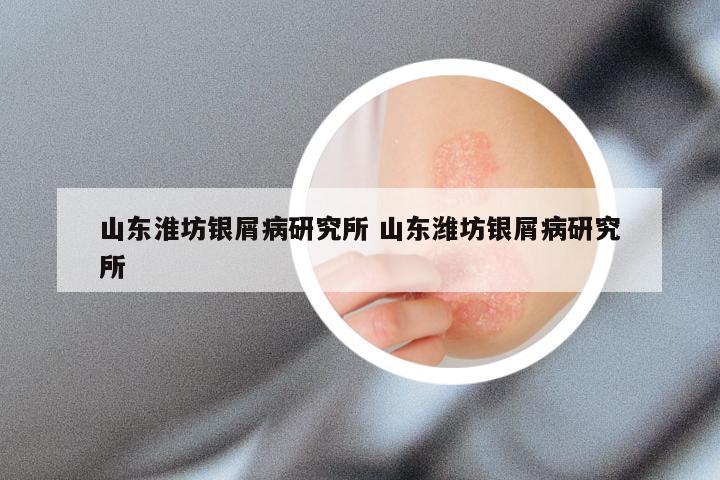 山东淮坊银屑病研究所 山东潍坊银屑病研究所