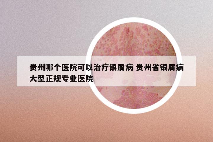 贵州哪个医院可以治疗银屑病 贵州省银屑病大型正规专业医院