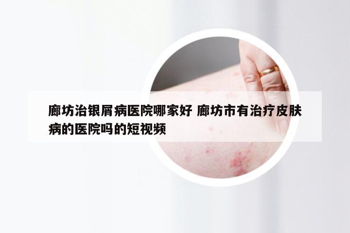 廊坊治银屑病医院哪家好 廊坊市有治疗皮肤病的医院吗的短视频