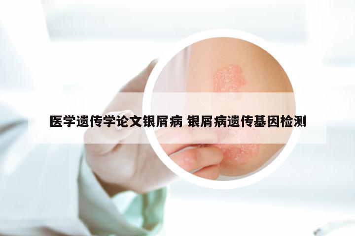 医学遗传学论文银屑病 银屑病遗传基因检测