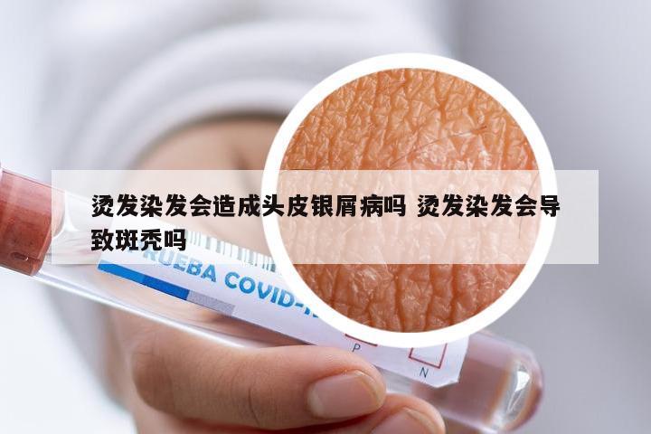 烫发染发会造成头皮银屑病吗 烫发染发会导致斑秃吗