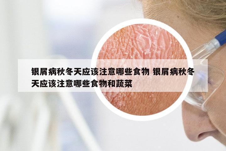 银屑病秋冬天应该注意哪些食物 银屑病秋冬天应该注意哪些食物和蔬菜