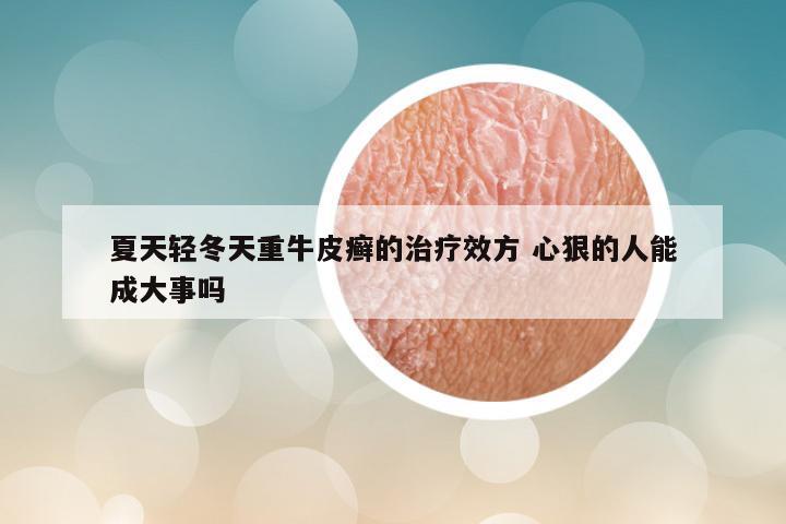 夏天轻冬天重牛皮癣的治疗效方 心狠的人能成大事吗