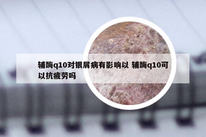 辅酶q10对银屑病有影响以 辅酶q10可以抗疲劳吗