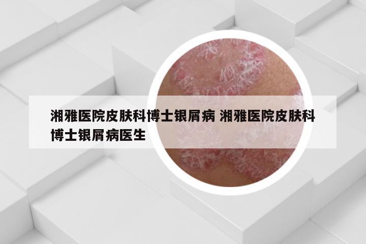 湘雅医院皮肤科博士银屑病 湘雅医院皮肤科博士银屑病医生