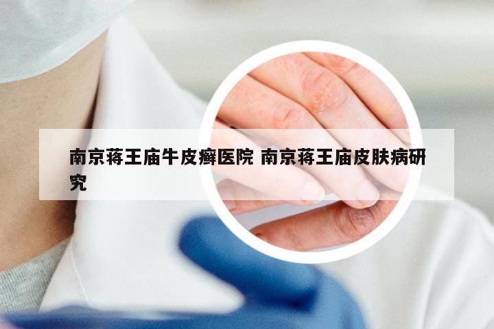 南京蒋王庙牛皮癣医院 南京蒋王庙皮肤病研究