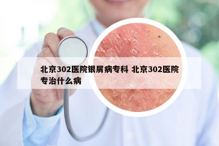 北京302医院银屑病专科 北京302医院专治什么病