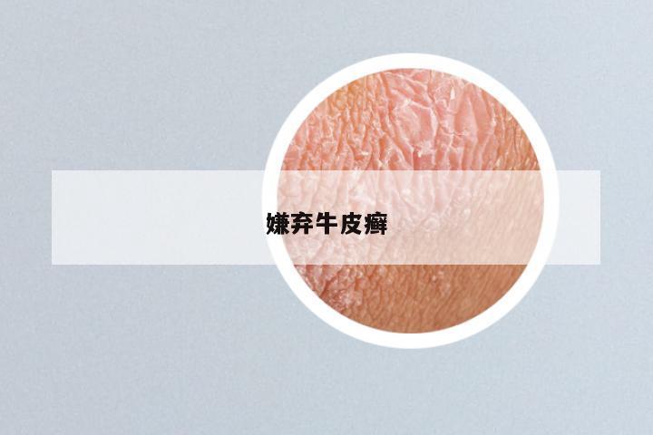 嫌弃牛皮癣