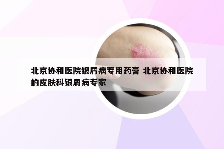 北京协和医院银屑病专用药膏 北京协和医院的皮肤科银屑病专家