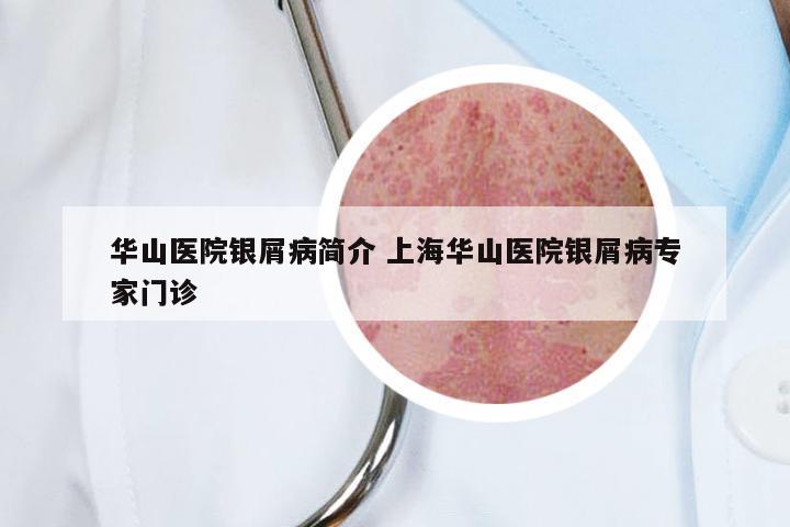 华山医院银屑病简介 上海华山医院银屑病专家门诊