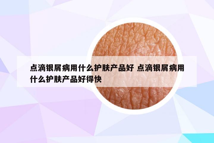 点滴银屑病用什么护肤产品好 点滴银屑病用什么护肤产品好得快