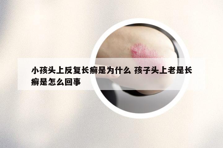 小孩头上反复长癣是为什么 孩子头上老是长癣是怎么回事