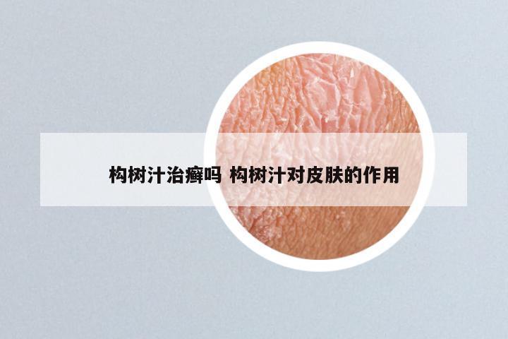 构树汁治癣吗 构树汁对皮肤的作用